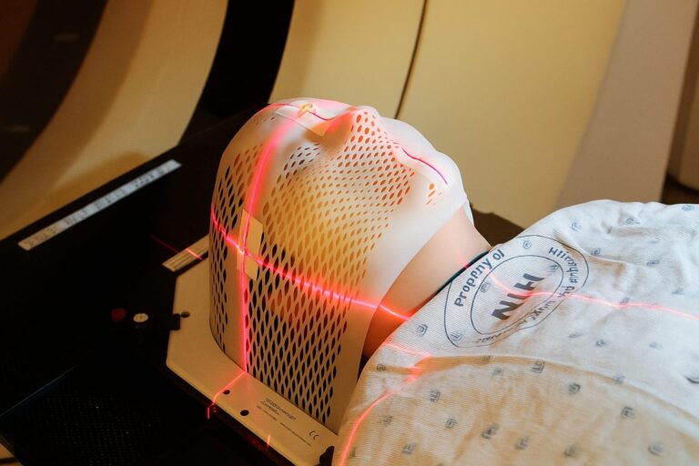 Patient undergoing advanced proton arc therapy with rotating beam technology, illustrating precise cancer treatment while preserving surrounding healthy tissue.
